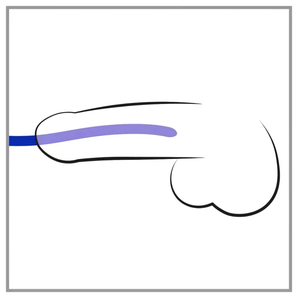 You2Toys - dilator - zestaw silikonowych dilatorów (3 sztuki)